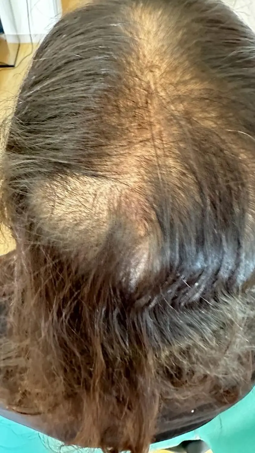 Vor der Haarbehandlung durch die Hausarztpraxis Pels und Anand