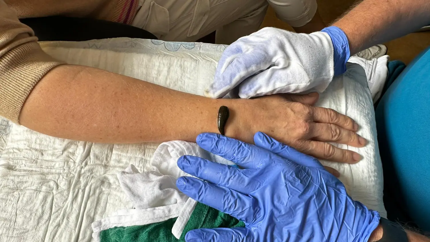 Blutegeltherapie in der Humanmedizin von Hausarztpraxis Pels und Anand