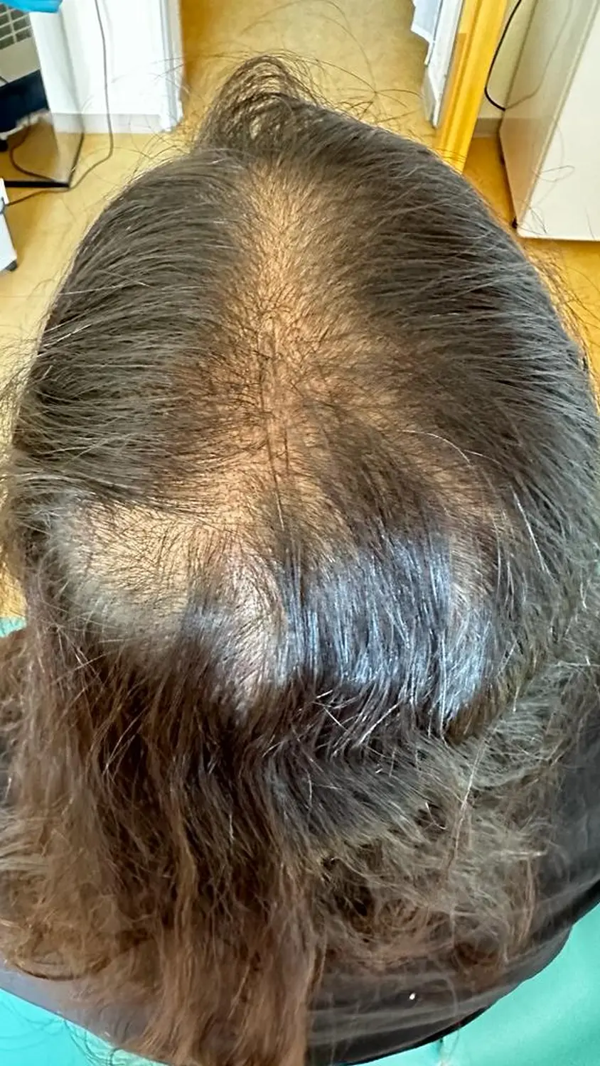 Vor der Haarbehandlung durch die Hausarztpraxis Pels und Anand