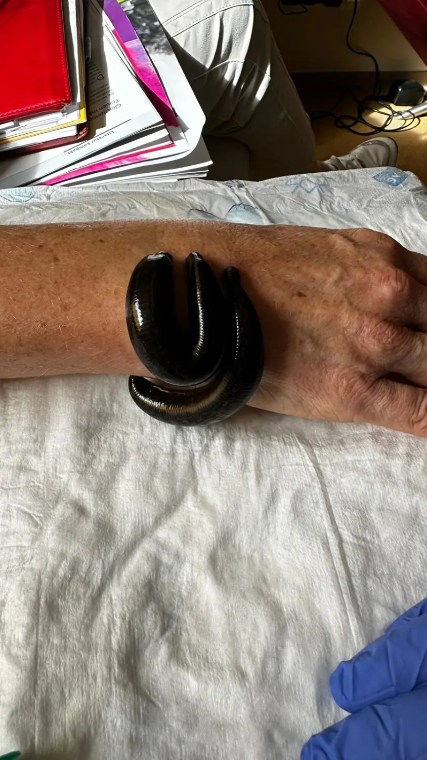 Blutegeltherapie in der Humanmedizin von Hausarztpraxis Pels und Anand
