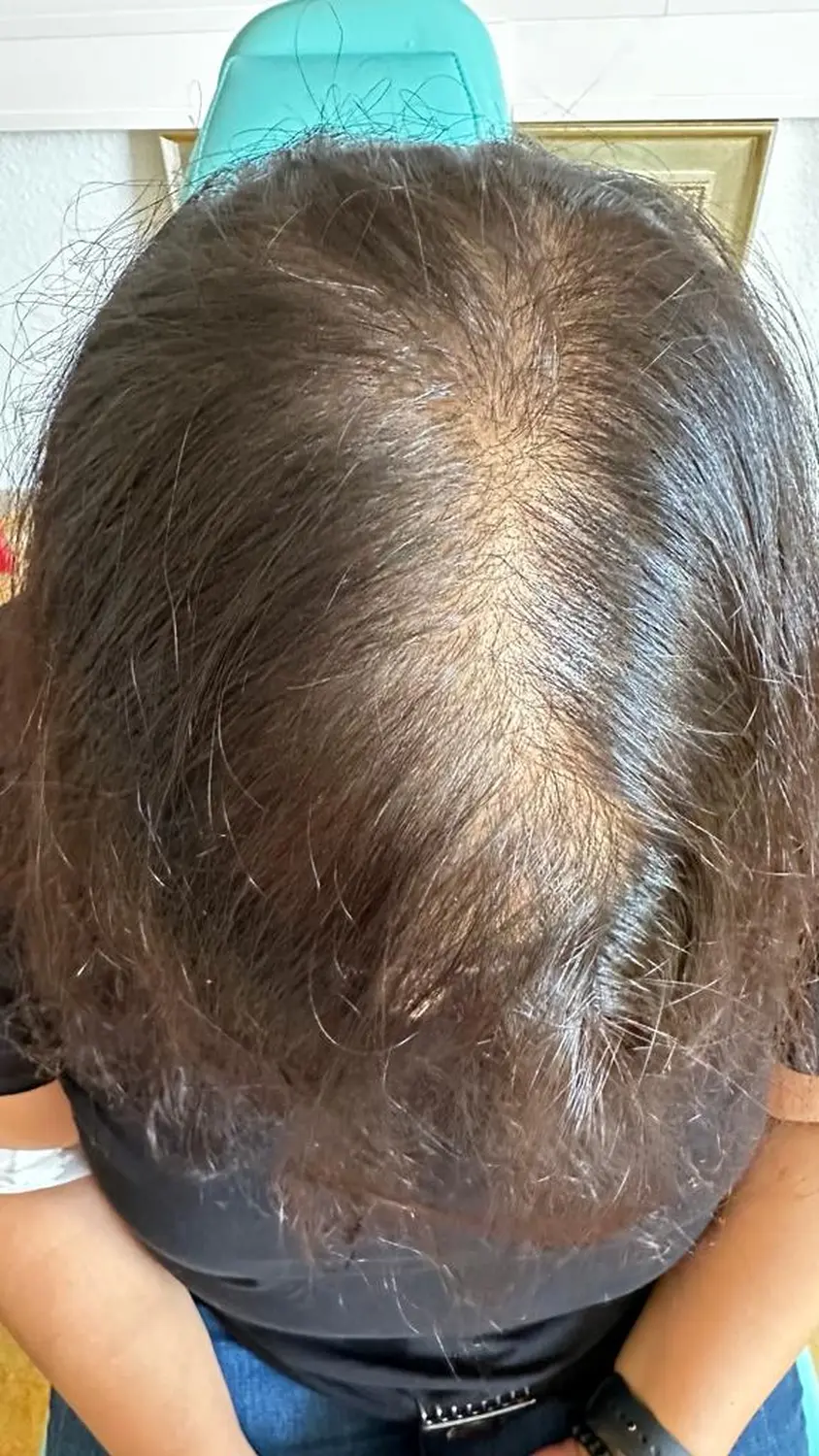 Vor der Haarbehandlung durch die Hausarztpraxis Pels und Anand